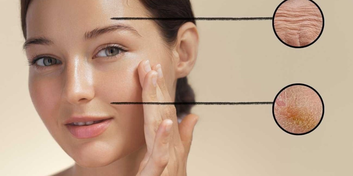 Anti Aging Service in Northwest DC | Spa Chevy Chase